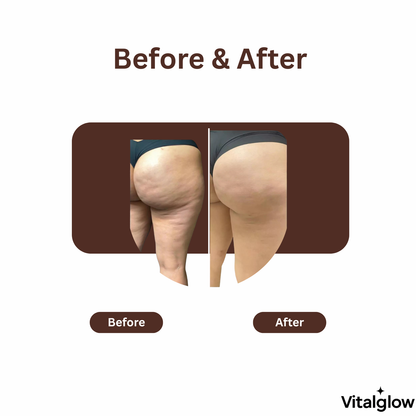 VitalGlow™ Cellulite Massage Oil